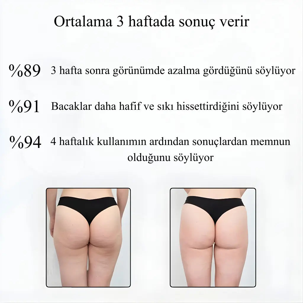 FitTech 3D Şekillendirici Kompresyon Taytı